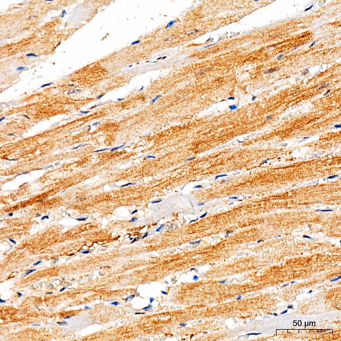 Rabbit anti-RYR2 Polyclonal Antibody