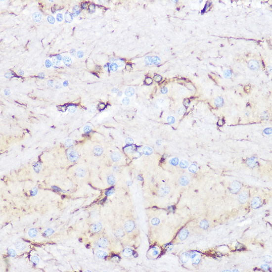 Rabbit anti-GFAP Polyclonal Antibody