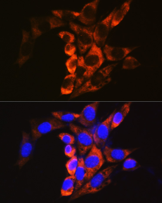 Rabbit anti-CAPN1 Polyclonal Antibody