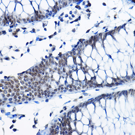 Rabbit anti-RPP25 Polyclonal Antibody