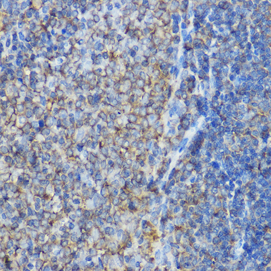 Rabbit anti-ARPC2 Polyclonal Antibody