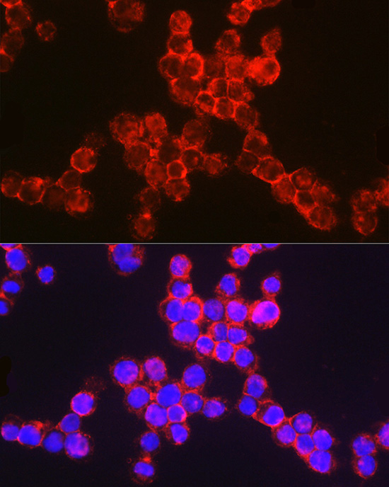 Rabbit anti-ITGAM Polyclonal Antibody