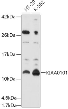 Rabbit anti-KIAA0101 Polyclonal Antibody