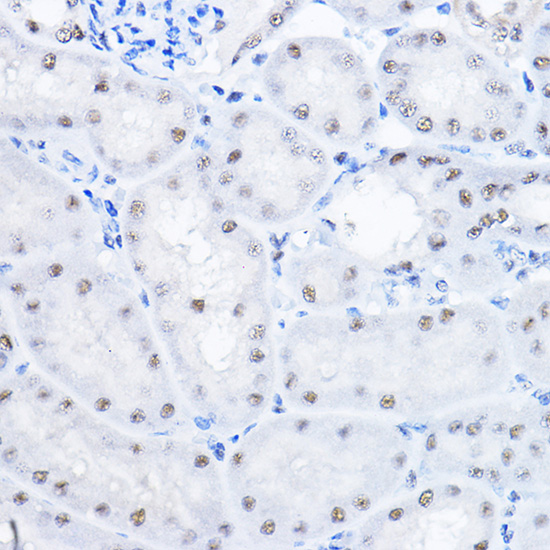 Rabbit anti-SMEK1 Polyclonal Antibody