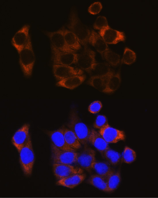 Rabbit anti-CAPN1 Polyclonal Antibody