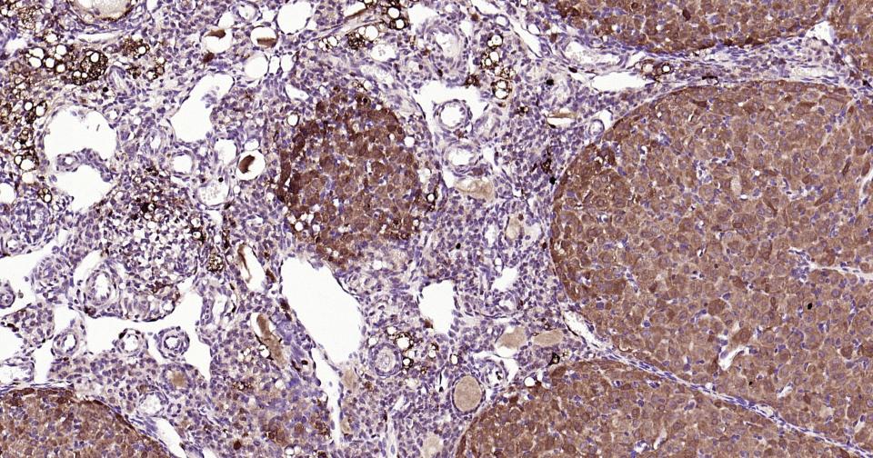 Rabbit anti-Galectin 3 Polyclonal Antibody