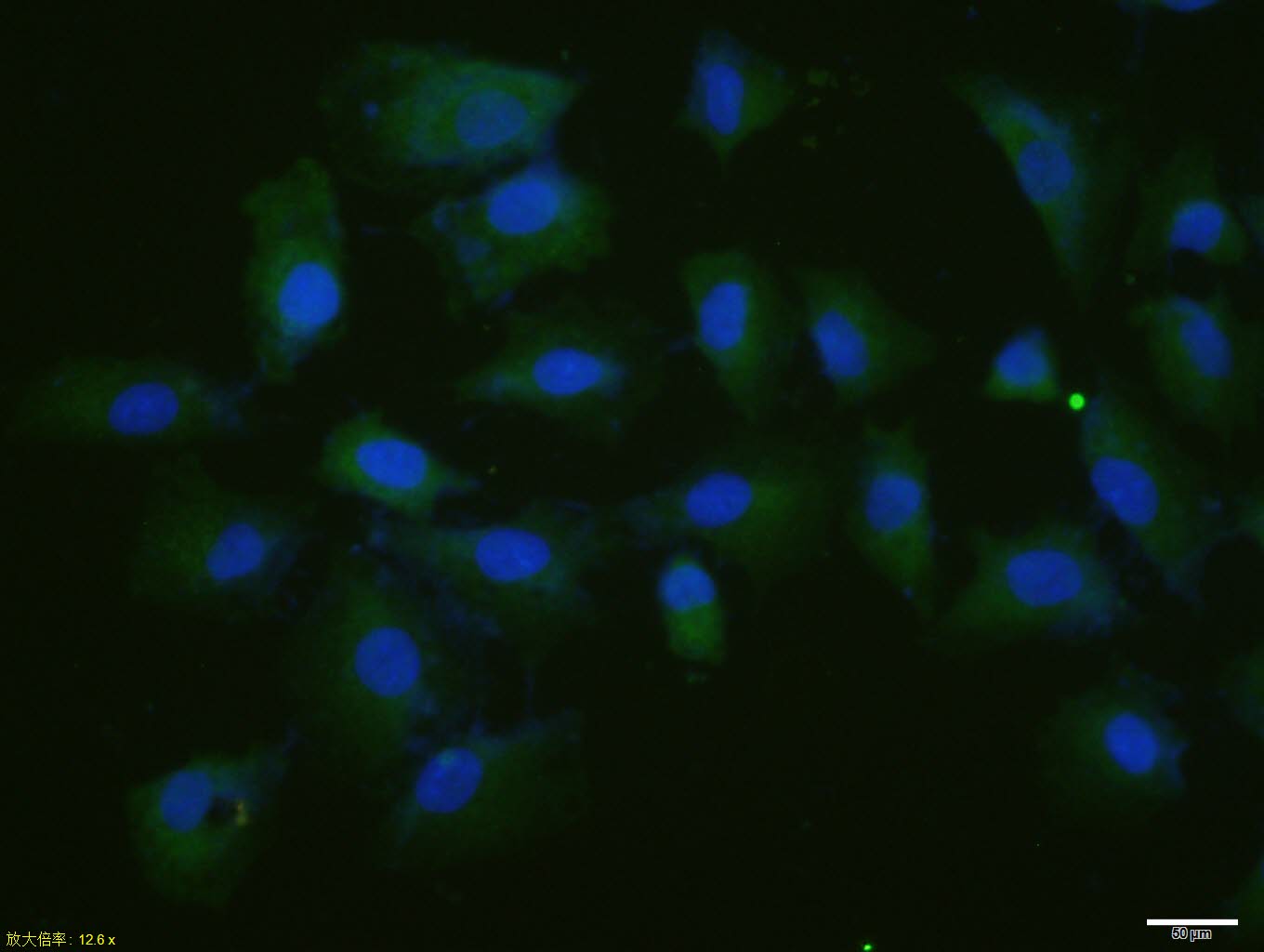 Rabbit anti-Phospho-P53(Thr55) Polyclonal Antibody