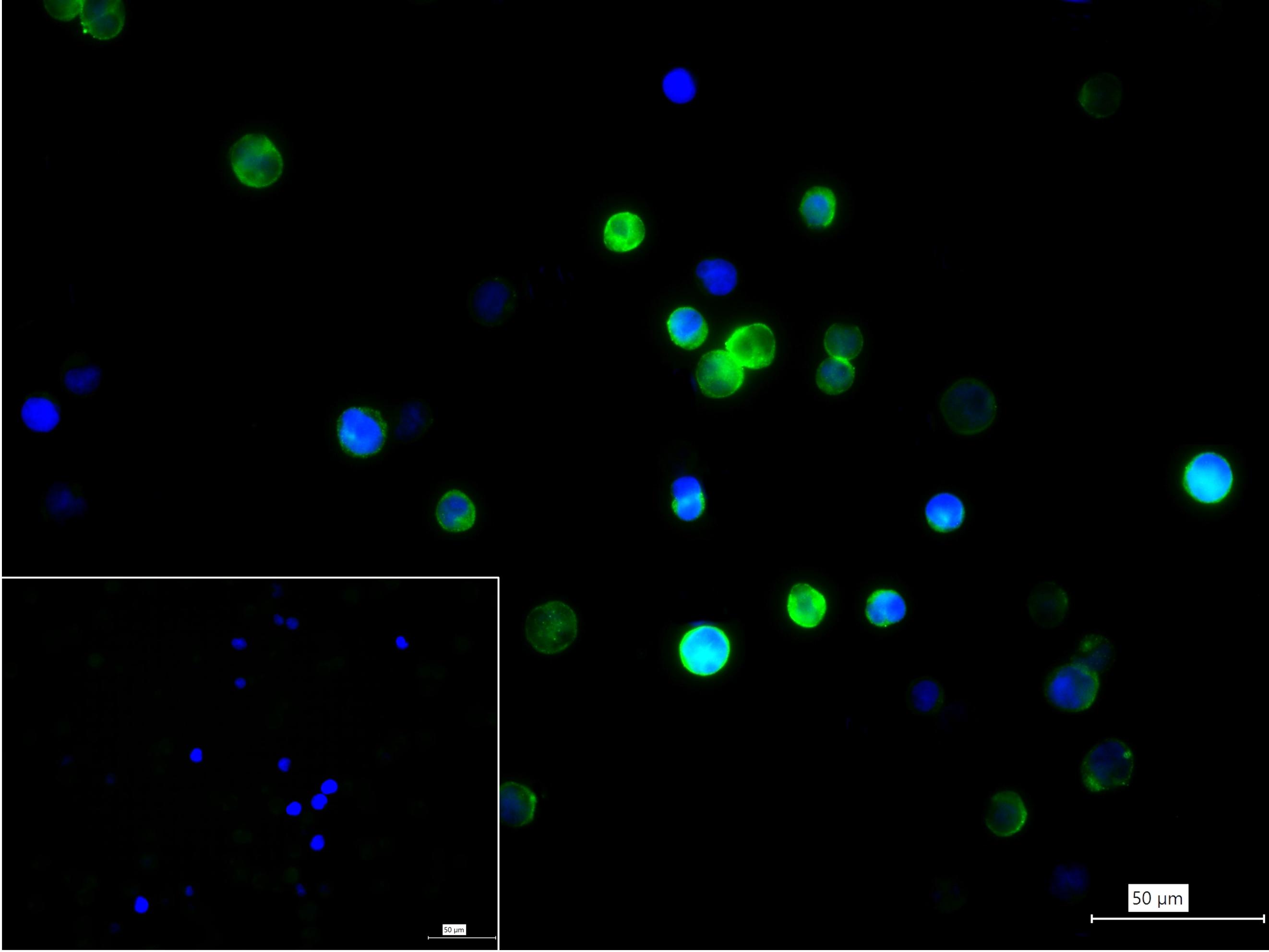 Rabbit anti-Macrophage Mannose Receptor 1 Monoclonal Antibody