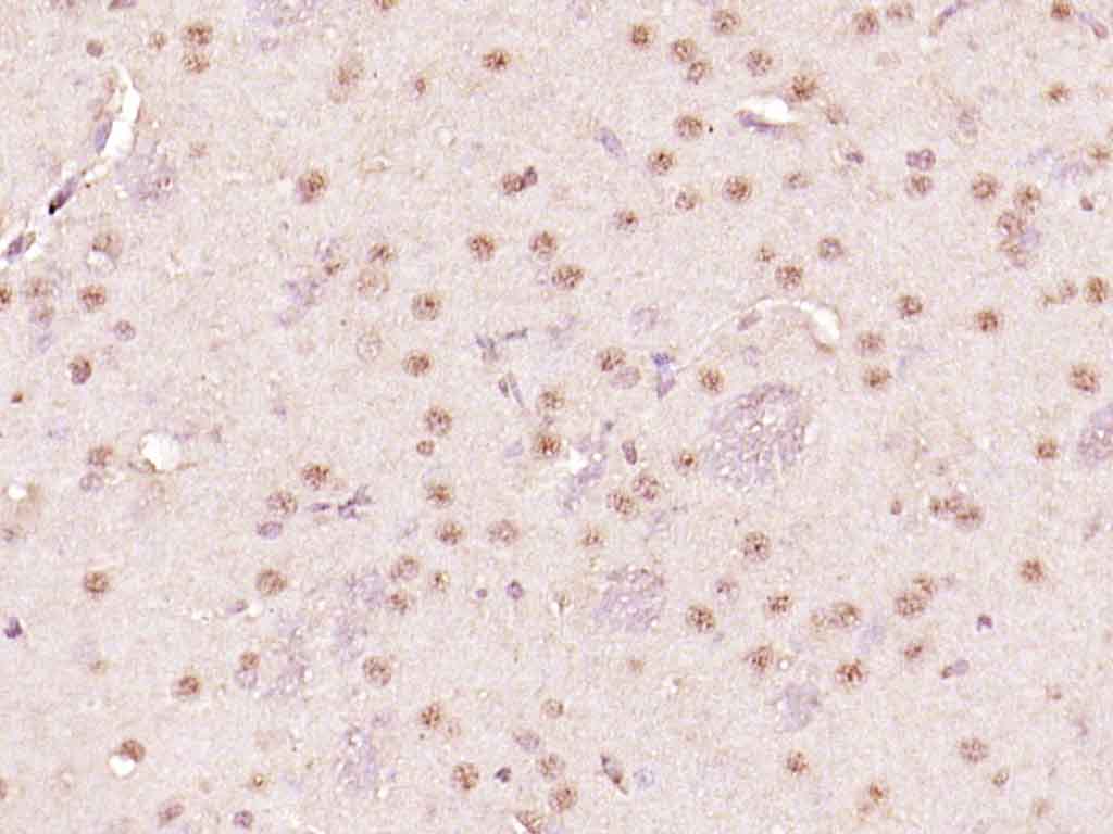 Rabbit anti-Phospho-Histone H1.4(Thr18) Polyclonal Antibody