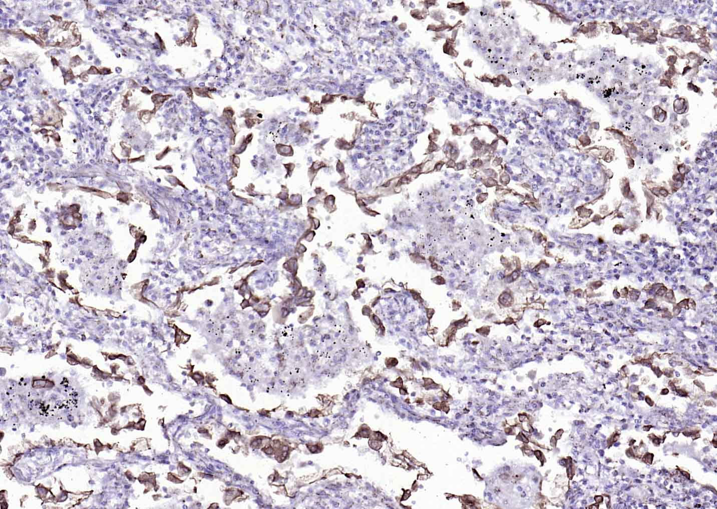 Mouse anti-Cytokeratin 8 Monoclonal Antibody