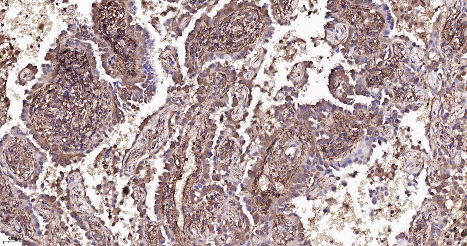 Rabbit anti-NFKB p65 Monoclonal Antibody