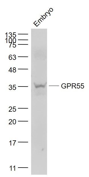 Rabbit anti-GPR55 Polyclonal Antibody