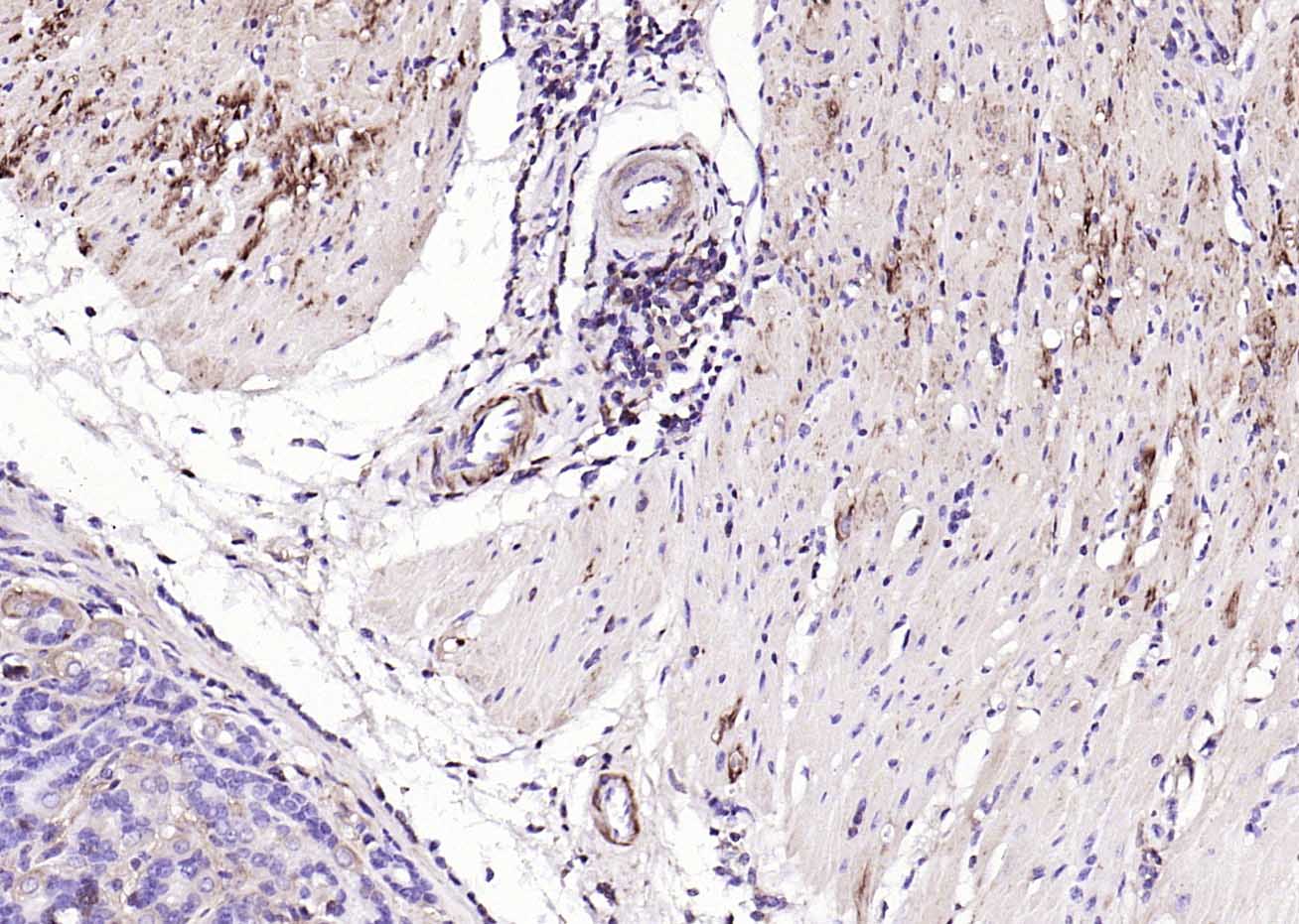 Rabbit anti-α Smooth Muscle Actin Polyclonal Antibody