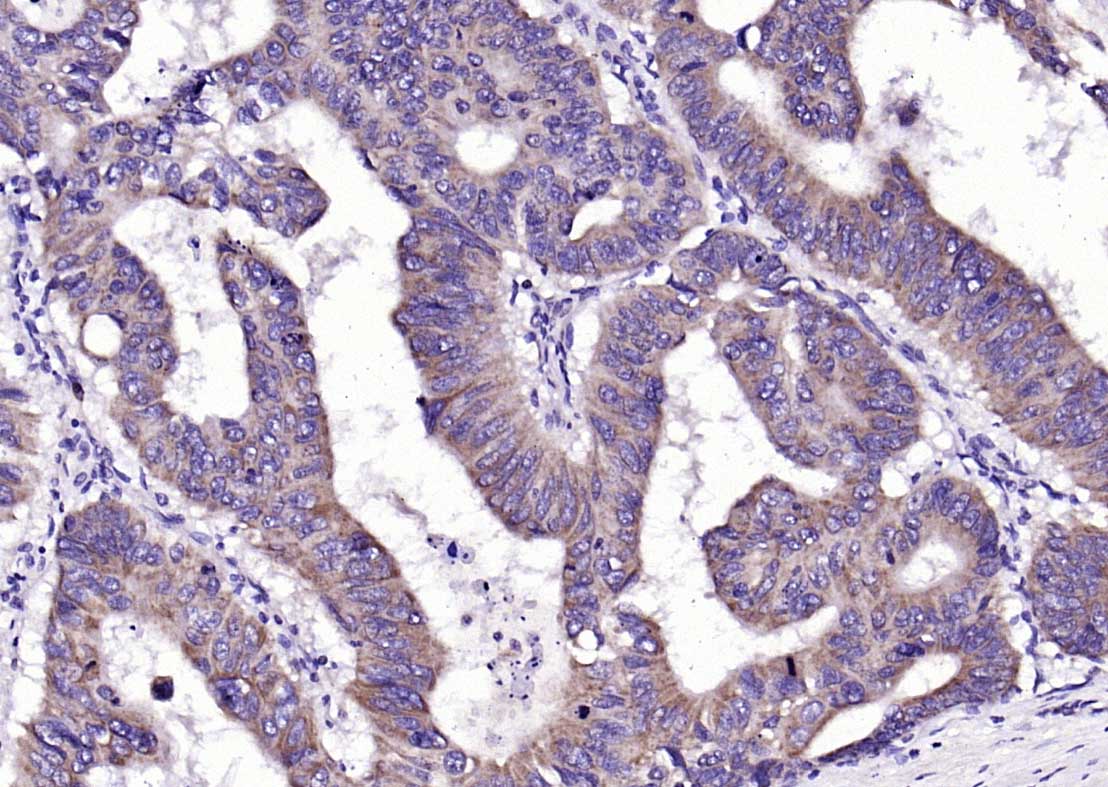 Rabbit anti-Phospho-FAK(Tyr861) Polyclonal Antibody