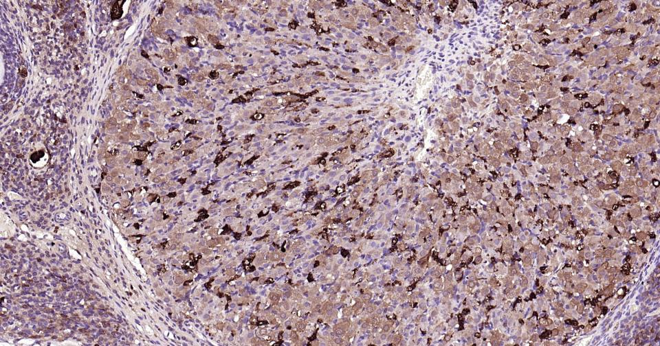 Rabbit anti-Galectin 3 Polyclonal Antibody