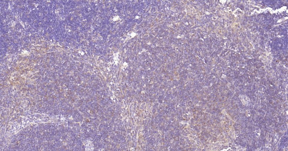 Rabbit anti-NFKB p65 Monoclonal Antibody