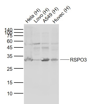 Rabbit anti-RSPO3 Polyclonal Antibody