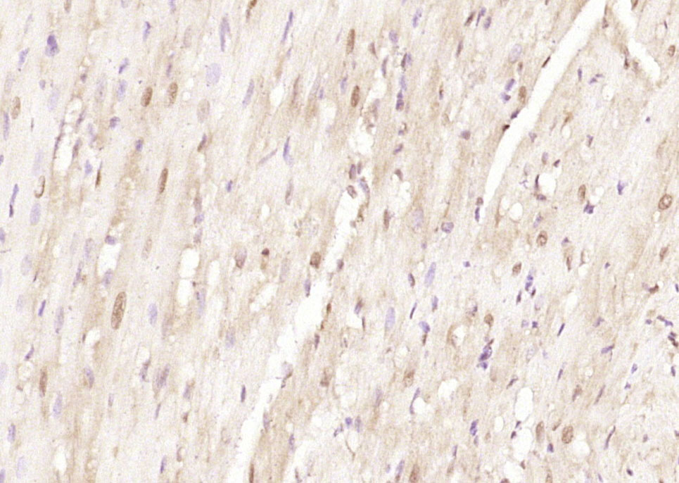 Rabbit Anti-LRRC2 Polyclonal Antibody