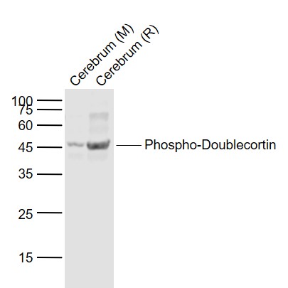 Rabbit anti-Phospho-Doublecortin(Ser128) Polyclonal Antibody