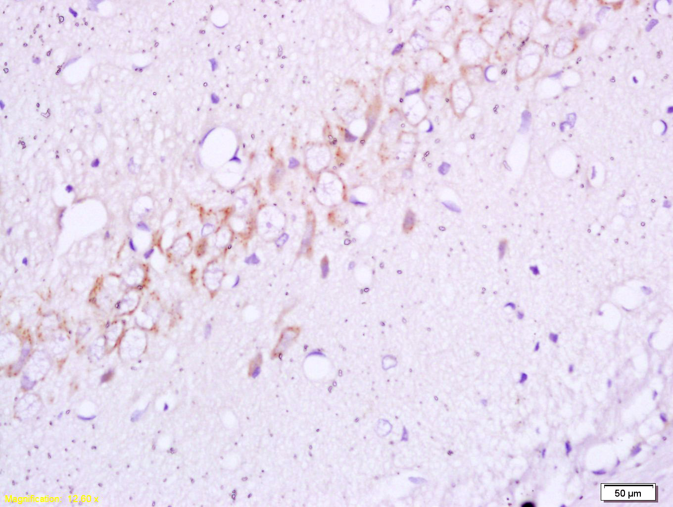 Rabbit anti-Phospho-Insulin Receptor β(Tyr1355) Polyclonal Antibody