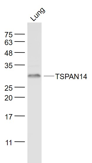 Rabbit anti-TSPAN14 Polyclonal Antibody