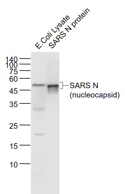 Mouse anti-SARS-CoV Nucleocapsid Monoclonal Antibody