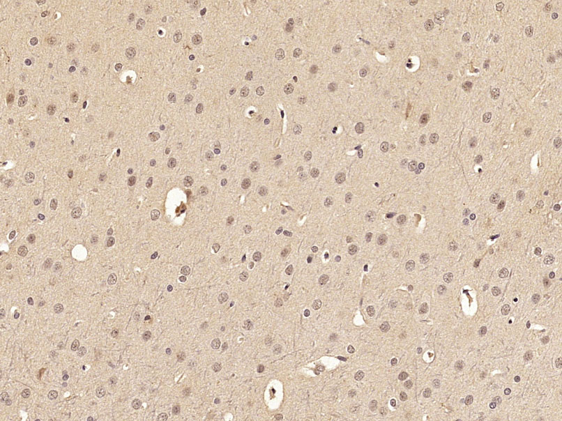 Rabbit anti-Phospho-FoxO3a(Ser318+Ser321) Polyclonal Antibody