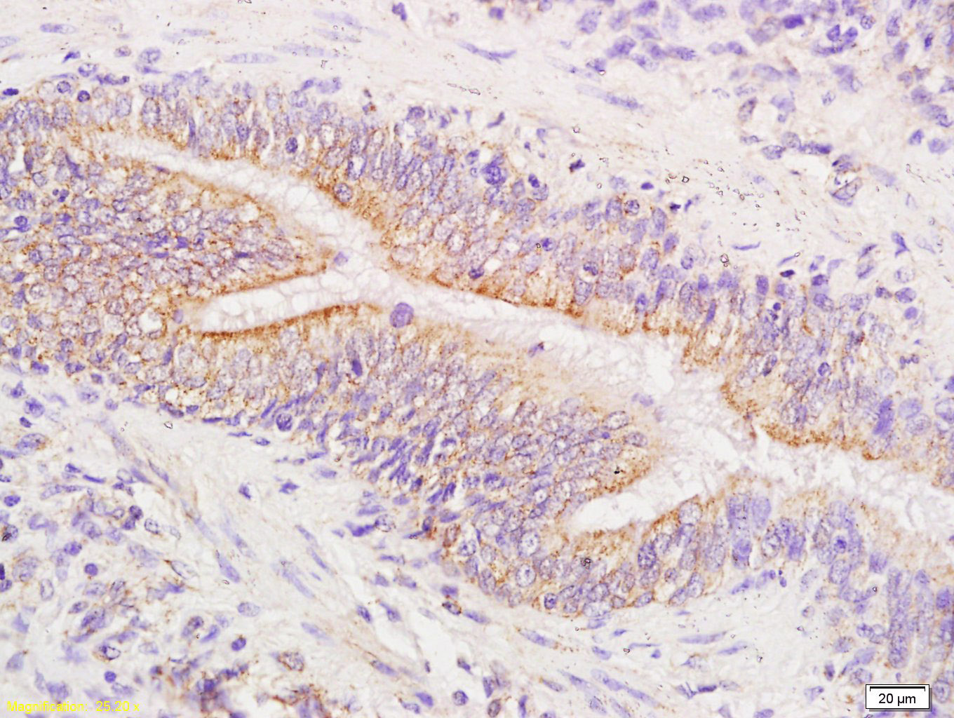 Rabbit anti-Phospho-FAK(Tyr576+Tyr577) Polyclonal Antibody