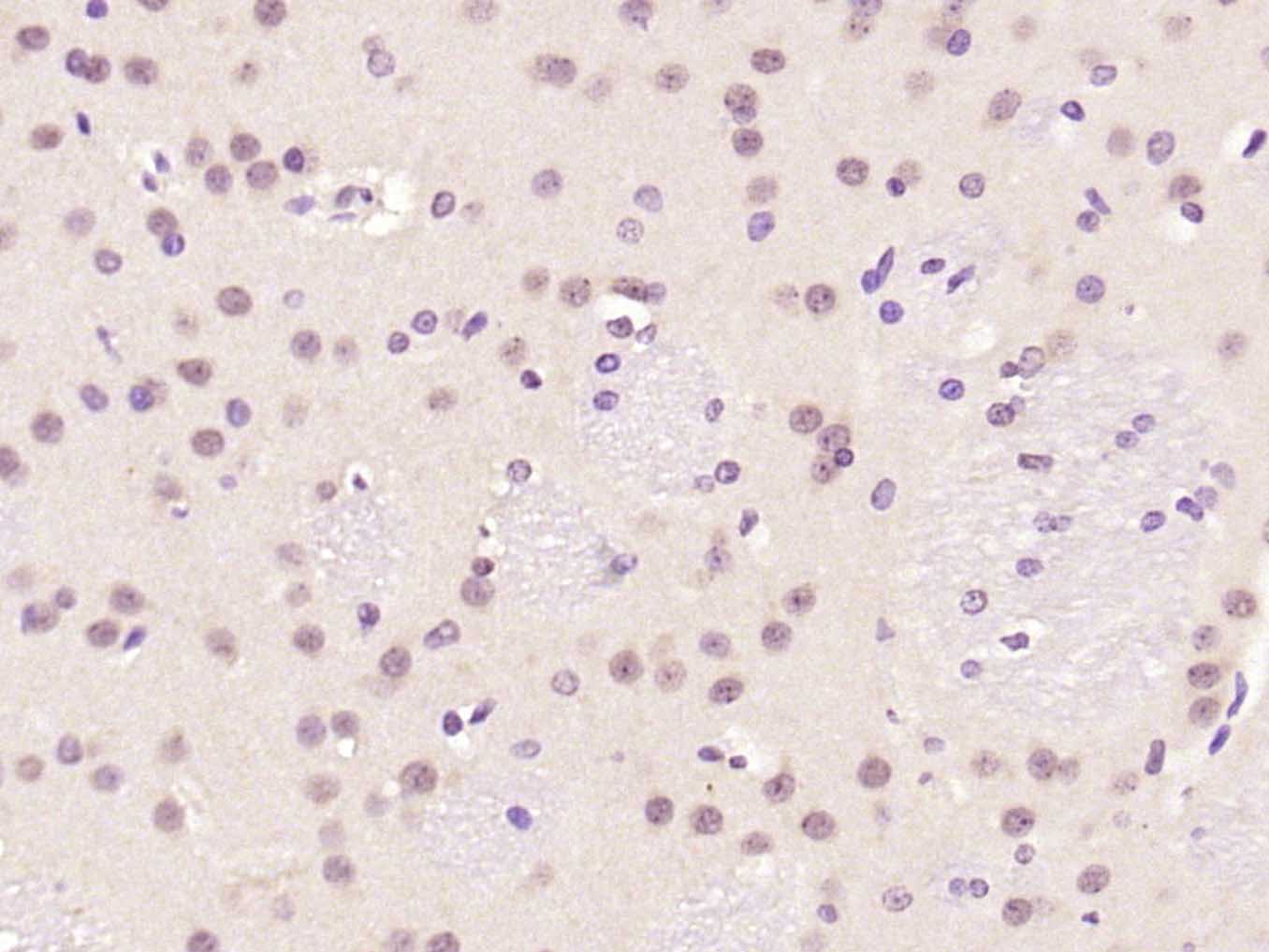 Rabbit anti-Phospho-c-Fos(Ser32) Polyclonal Antibody