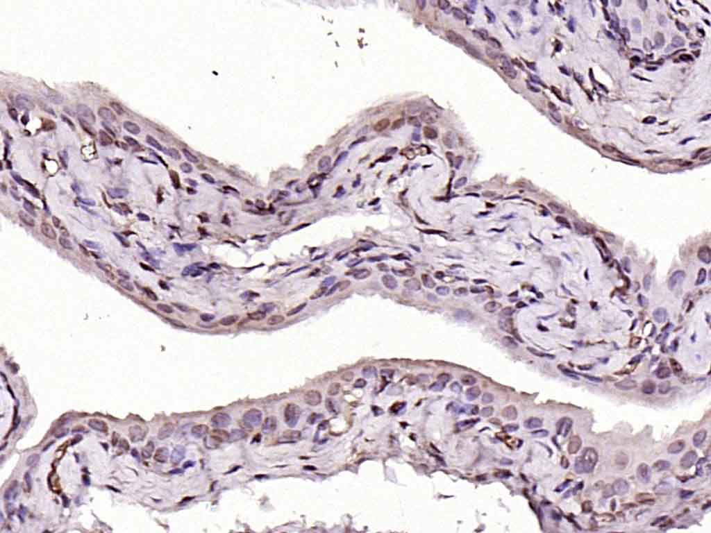 Rabbit anti-MYCL Polyclonal Antibody
