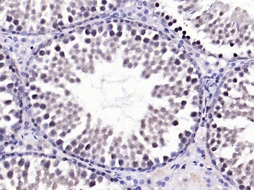 Rabbit anti-Phospho-FAK(Tyr576+Tyr577) Polyclonal Antibody