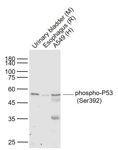 Rabbit anti-Phospho-P53(Ser392) Monoclonal Antibody