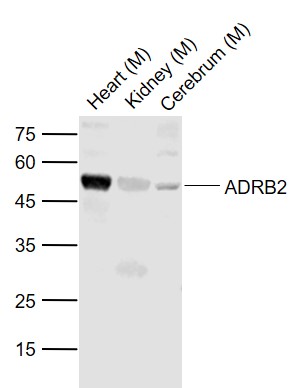 Rabbit anti-ADRB2 Polyclonal Antibody