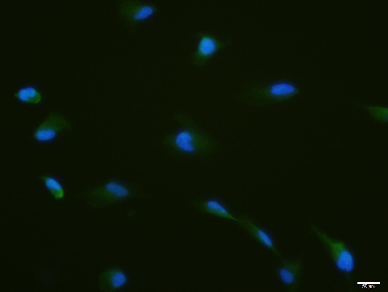 Rabbit anti-Phospho-YB1(Ser102) Polyclonal Antibody