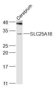 Rabbit anti-SLC25A18 Polyclonal Antibody