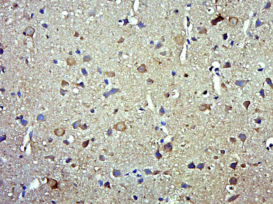 Rabbit anti-Phospho-Smad3(Ser208) Polyclonal Antibody