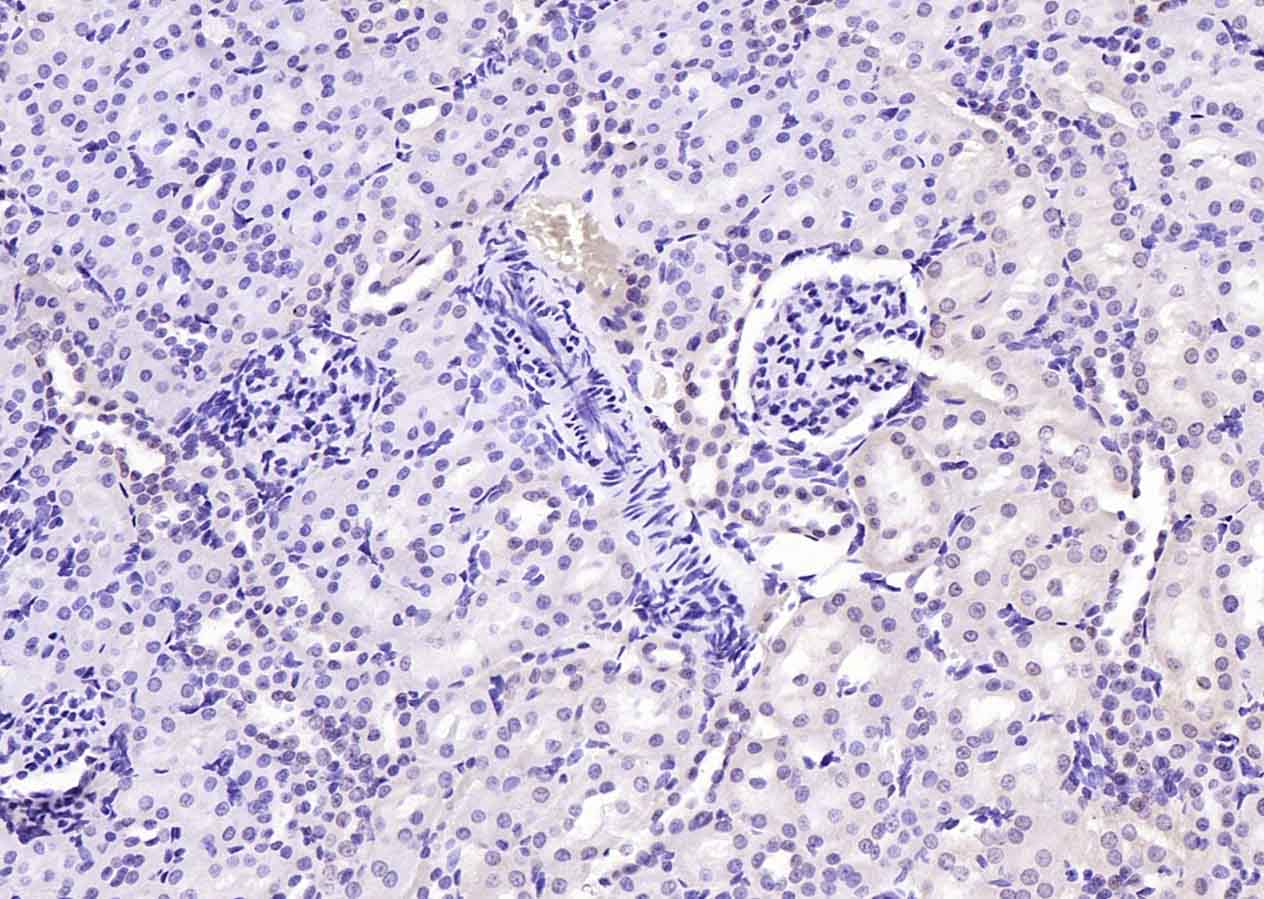 Rabbit anti-Phospho-PI3 Kinase p110 β(Ser1070) Polyclonal Antibody