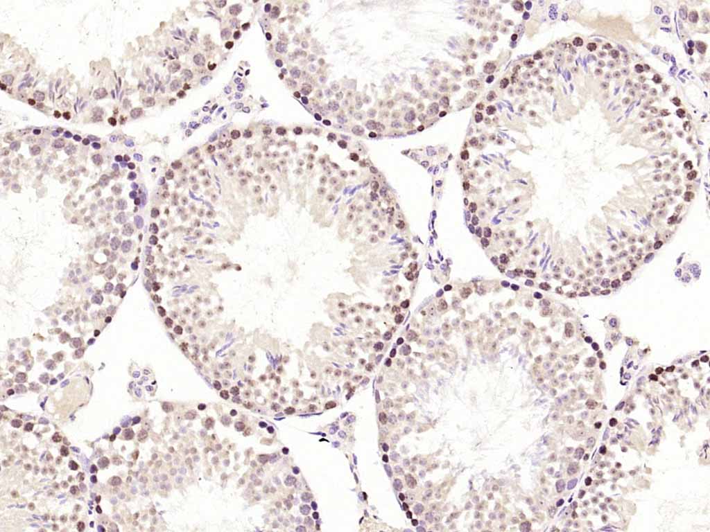 Rabbit anti-Phospho-PKC δ(Ser645) Polyclonal Antibody