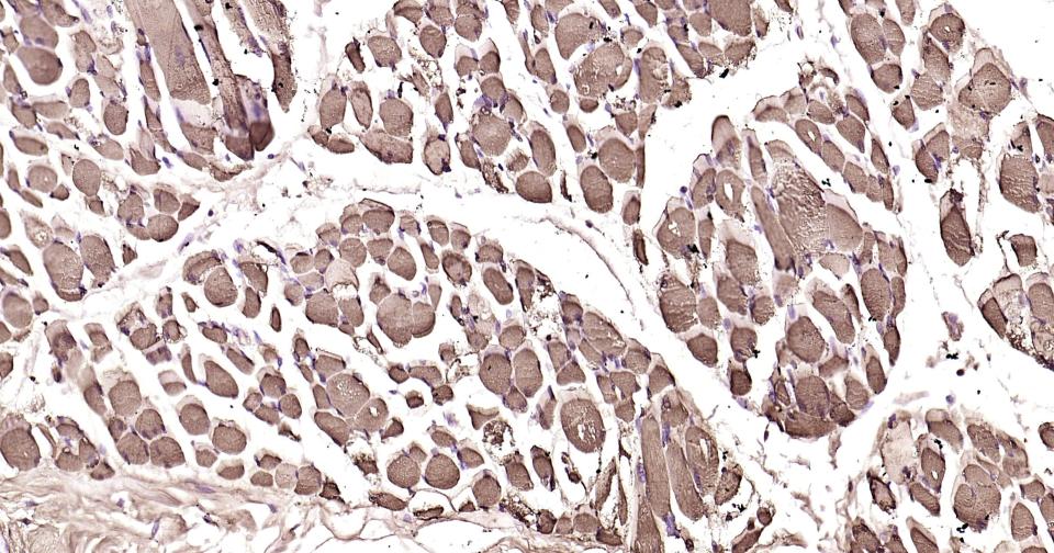 Rabbit anti-Myoglobin Polyclonal Antibody