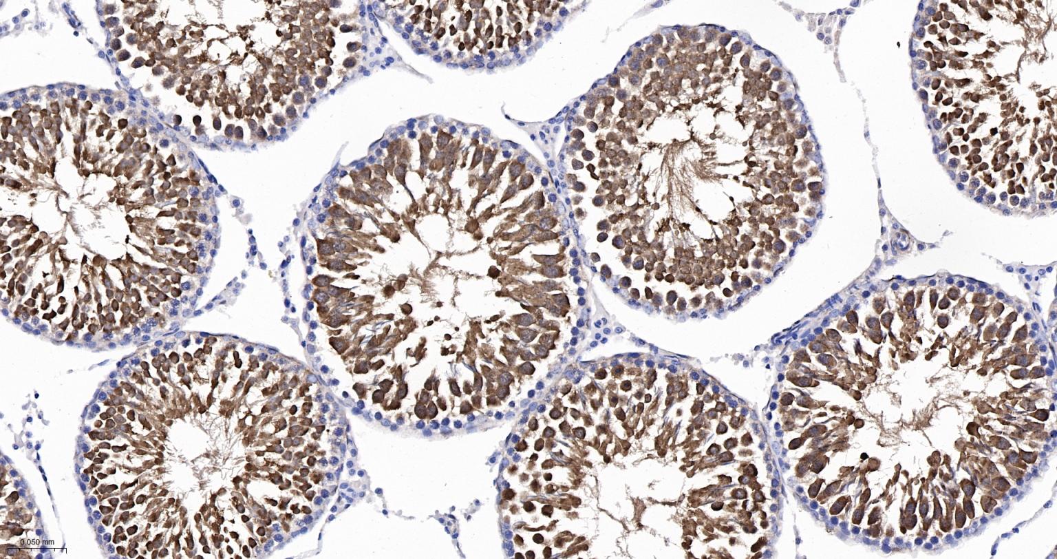 Rabbit anti-HSP70 Monoclonal Antibody