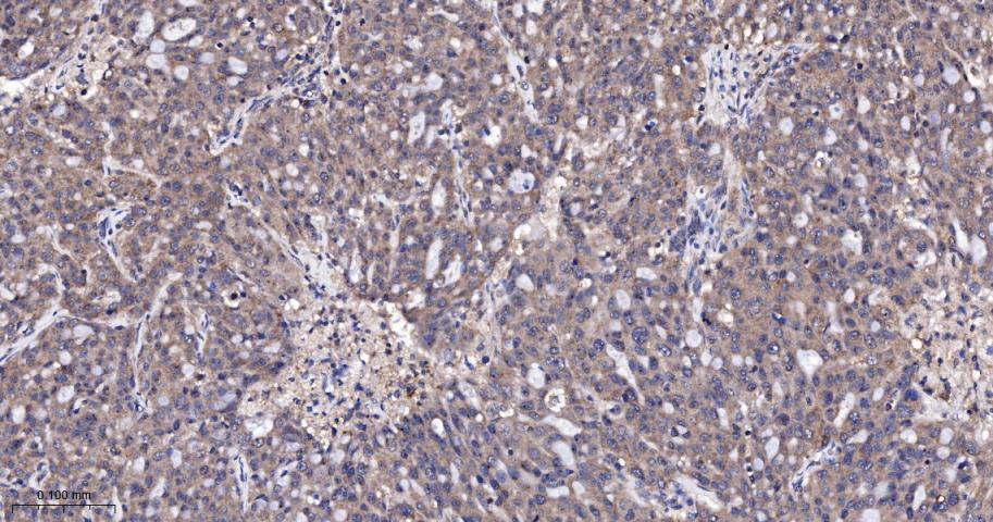 Rabbit anti-TSG101 Monoclonal Antibody