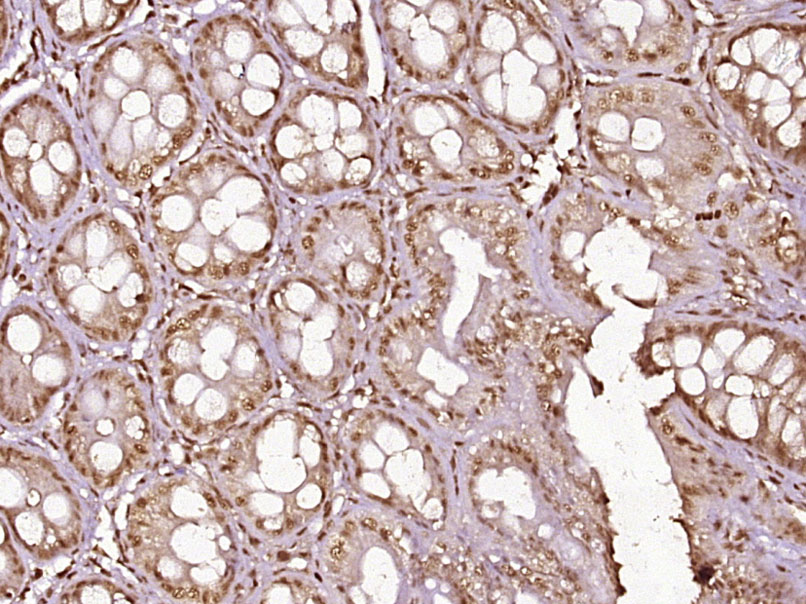 Rabbit anti-Phospho-NFKB p65(Thr254) Polyclonal Antibody