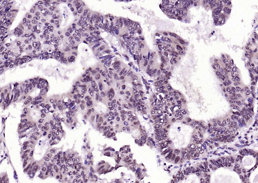 Rabbit anti-Phospho-FADD(Ser194) Polyclonal Antibody