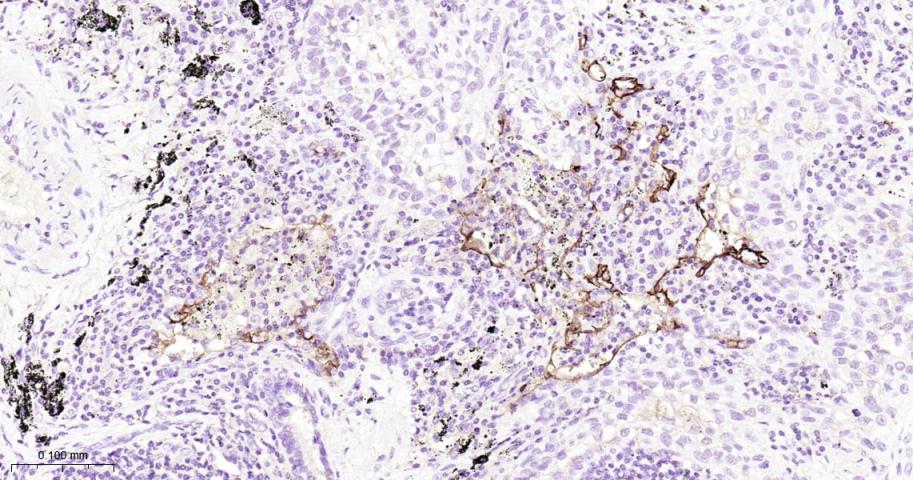 Mouse anti-ICAM1/CD54 Monoclonal Antibody