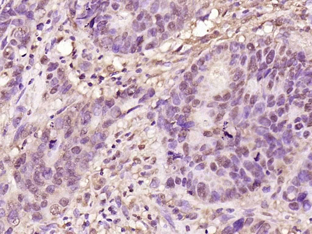 Rabbit anti-Phospho-NFKB1(Ser907) Polyclonal Antibody