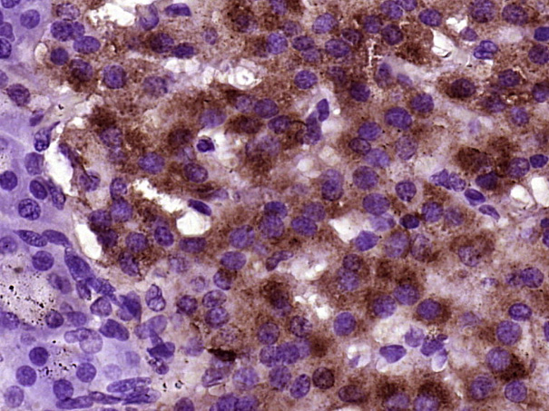 Rabbit Anti-BTBD17 Polyclonal Antibody