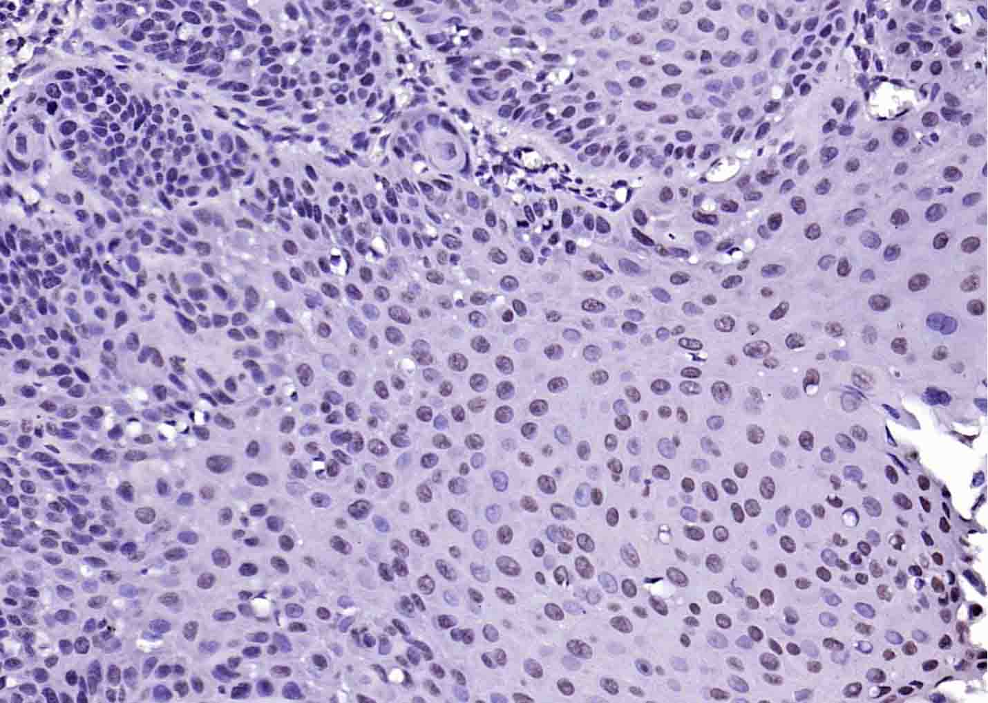 Rabbit anti-Histone H3(acetyl K4) Polyclonal Antibody