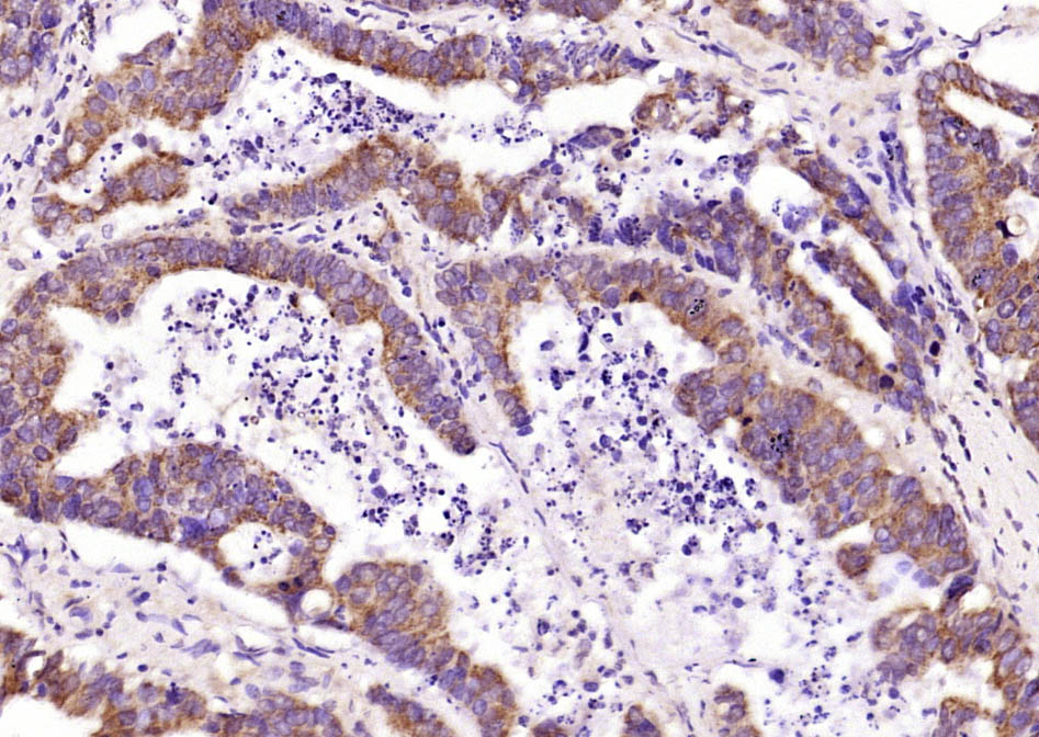 Rabbit anti-IKK γ Polyclonal Antibody