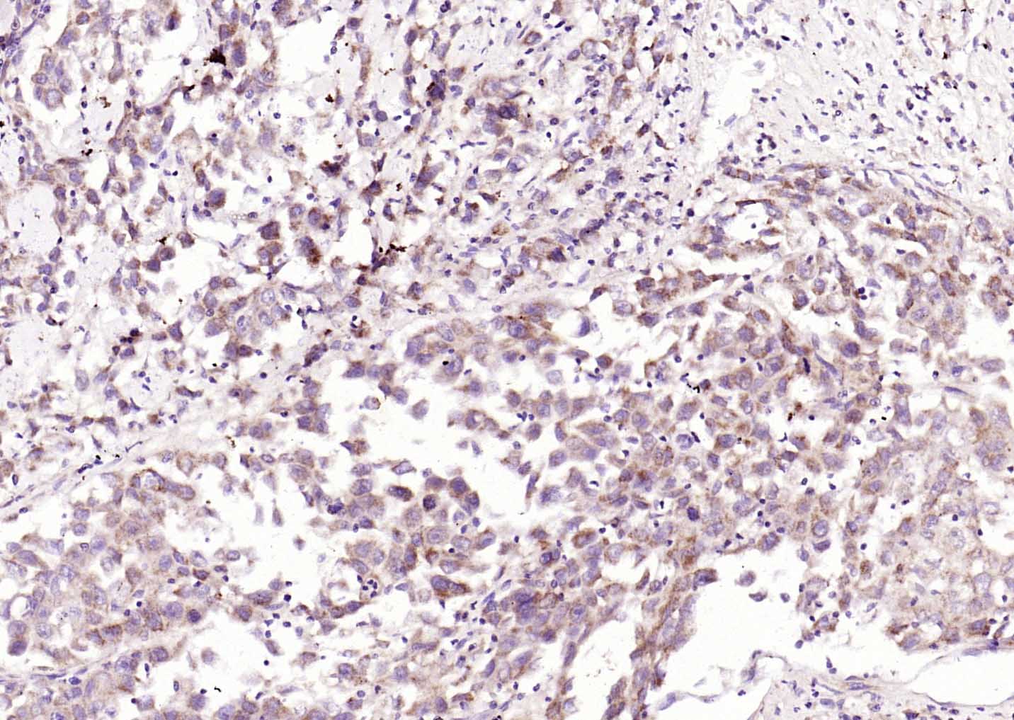 Rabbit anti-TNFR1 Polyclonal Antibody