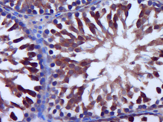 Rabbit anti-TdT Polyclonal Antibody